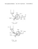 DEVICES AND METHODS FOR GASTROINTESTINAL BYPASS diagram and image