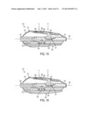 CATHETER VALVE AND METHODS OF USING SAME diagram and image