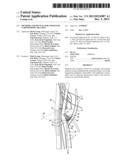 Methods and Devices for Cryogenic Carotid Body Ablation diagram and image