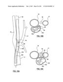 Methods and Devices for Cryogenic Carotid Body Ablation diagram and image