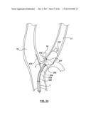 Methods and Devices for Cryogenic Carotid Body Ablation diagram and image