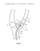 Methods and Devices for Cryogenic Carotid Body Ablation diagram and image