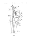 Percutaneous Methods and Devices for Carotid Body Ablation diagram and image