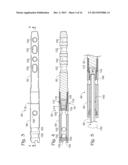 ARTICULATED INTRAMEDULLARY NAIL diagram and image