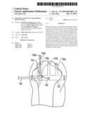 Methods and Devices for Forming Bone Tunnels diagram and image