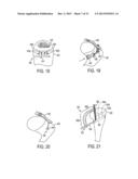 Methods and Devices for Forming Bone Tunnels diagram and image