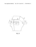 Methods and Devices for Forming Bone Tunnels diagram and image