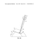 Methods and Devices for Forming Bone Tunnels diagram and image