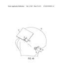 Methods and Devices for Forming Bone Tunnels diagram and image