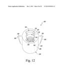 METHOD OF SURGICALLY PREPARING A PATIENT S FEMUR diagram and image