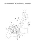 FEMORAL ORTHOPAEDIC SURGICAL INSTRUMENTS AND  METHOD OF USE OF SAME diagram and image