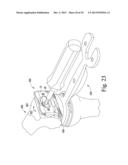 FEMORAL ORTHOPAEDIC SURGICAL INSTRUMENTS AND  METHOD OF USE OF SAME diagram and image