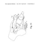 FEMORAL ORTHOPAEDIC SURGICAL INSTRUMENTS AND  METHOD OF USE OF SAME diagram and image