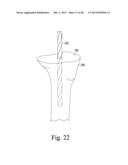 TIBIAL ORTHOPAEDIC SURGICAL INSTRUMENTS AND METHOD OF USING SAME diagram and image