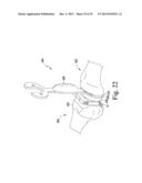 METHOD OF ASSEMBLING AND POSITIONING A FEMORAL ORTHOPAEDIC SURGICAL     INSTRUMENT diagram and image