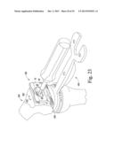 METHOD OF ASSEMBLING AND POSITIONING A FEMORAL ORTHOPAEDIC SURGICAL     INSTRUMENT diagram and image