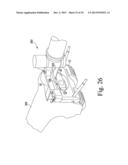 METHOD OF ASSEMBLING AND POSITIONING A FEMORAL ORTHOPAEDIC SURGICAL     INSTRUMENT diagram and image