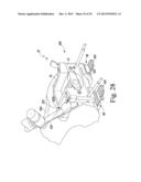 METHOD OF ASSEMBLING AND POSITIONING A FEMORAL ORTHOPAEDIC SURGICAL     INSTRUMENT diagram and image