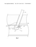 SYSTEMS, METHODS, AND DEVICES FOR CLOSING HOLES IN BODY LUMENS diagram and image