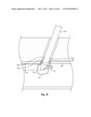 SYSTEMS, METHODS, AND DEVICES FOR CLOSING HOLES IN BODY LUMENS diagram and image