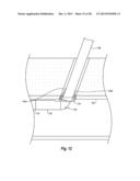 SYSTEMS, METHODS, AND DEVICES FOR CLOSING HOLES IN BODY LUMENS diagram and image