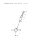 SYSTEMS, METHODS, AND DEVICES FOR CLOSING HOLES IN BODY LUMENS diagram and image