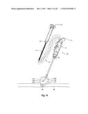 SYSTEMS, METHODS, AND DEVICES FOR CLOSING HOLES IN BODY LUMENS diagram and image