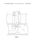 SYSTEMS, METHODS, AND DEVICES FOR CLOSING HOLES IN BODY LUMENS diagram and image