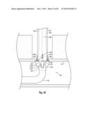 SYSTEMS, METHODS, AND DEVICES FOR CLOSING HOLES IN BODY LUMENS diagram and image