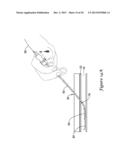 TISSUE PUNCTURE CLOSURE DEVICE diagram and image