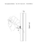 TISSUE PUNCTURE CLOSURE DEVICE diagram and image