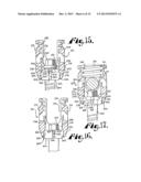 Polyaxial bone screw assembly diagram and image