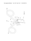 LOWER EXTREMITY FUSION DEVICES AND METHODS diagram and image