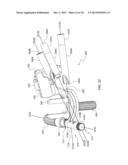 LOWER EXTREMITY FUSION DEVICES AND METHODS diagram and image