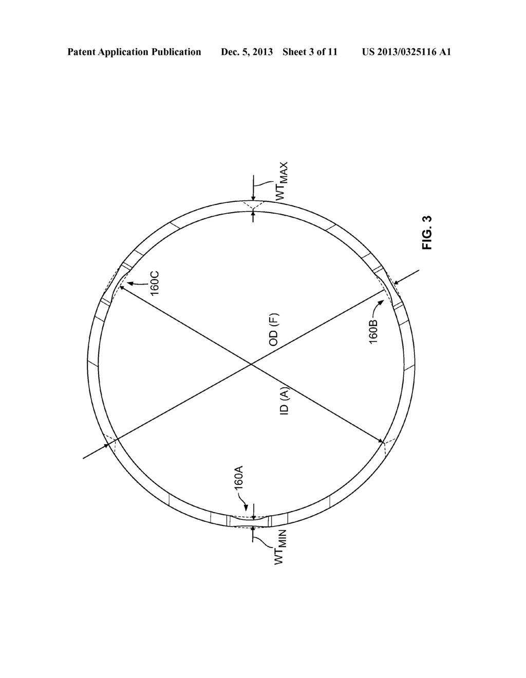 PROSTHETIC HEART VALVE HAVING A POLYMERIC STENT - diagram, schematic, and image 04