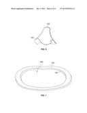 PROSTHETIC HEART VALVE HAVING A POLYMERIC STENT diagram and image