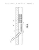 APPARATUS, SYSTEMS AND METHODS FOR MEDICAL DEVICE EXPANSION diagram and image