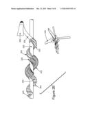 STREAMER CLEANING DEVICE AND METHOD diagram and image