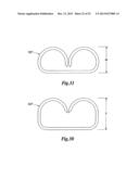 STAPLE CARTRIDGE COMPRISING A STAPLE DRIVER ARRANGEMENT diagram and image