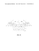 SURGICAL LIGHT WITH LED LIGHT GUIDING AND FOCUSING STRUCTURE AND METHOD diagram and image