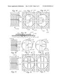 Stacked Caps with Connecting Stems diagram and image