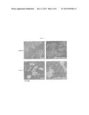 COMPOSITION CONTAINING HUMAN UMBILICAL CORD BLOOD-DERIVED MESENCHYMAL STEM     CELL FOR INDUCING DIFFERENTIATION AND PROLIFERATION OF NEURAL PRECURSOR     CELLS OR NEURAL STEM CELLS TO NEURAL CELLS diagram and image