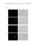 METAL-BASED THIOPHENE PHOTODYNAMIC COMPOUNDS AND THEIR USE diagram and image