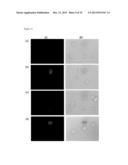 METAL-BASED THIOPHENE PHOTODYNAMIC COMPOUNDS AND THEIR USE diagram and image