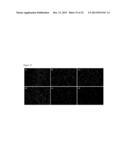 METAL-BASED THIOPHENE PHOTODYNAMIC COMPOUNDS AND THEIR USE diagram and image