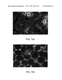 METHODS FOR TREATING VASCULAR LEAK SYNDROME diagram and image