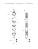 BLOOD PUMP WITH EXPANDABLE CANNULA diagram and image