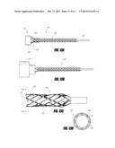 BLOOD PUMP WITH EXPANDABLE CANNULA diagram and image