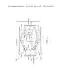 MAGNETICALLY MANEUVERABLE IN-VIVO DEVICE diagram and image