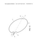 BASKET STYLE CARDIAC MAPPING CATHETER HAVING A FLEXIBLE ELECTRODE ASSEMBLY     FOR SENSING MONOPHASIC ACTION POTENTIALS diagram and image